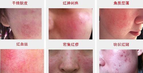 问鼎娱乐电子游戏 通过这三点，检测护肤品中是否含有激素