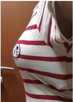 胸部整形安全_丰胸效果比较好的产品排名_假体隆胸