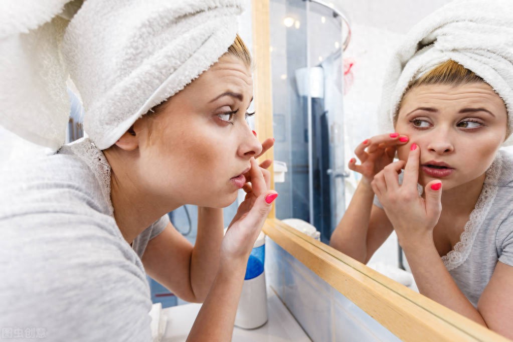 2025全年免费资料查询 痘痘到底能不能挤！！！怎么挤？