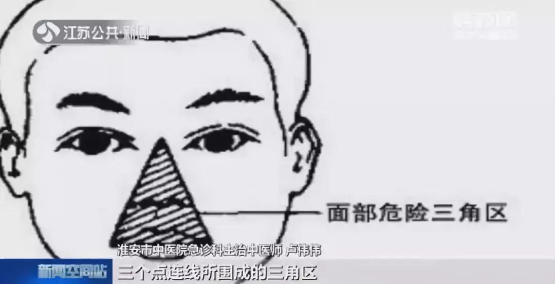 脸上痘痘感染_危险三角区挤痘后果_痘痘里的血要挤干净吗