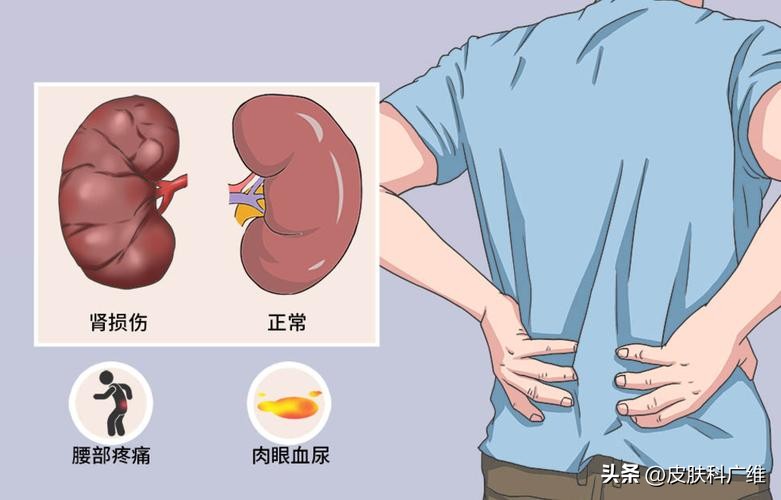 多吃酱油皮肤会变黑吗_酱油致癌吗 焦糖色素 食用安全