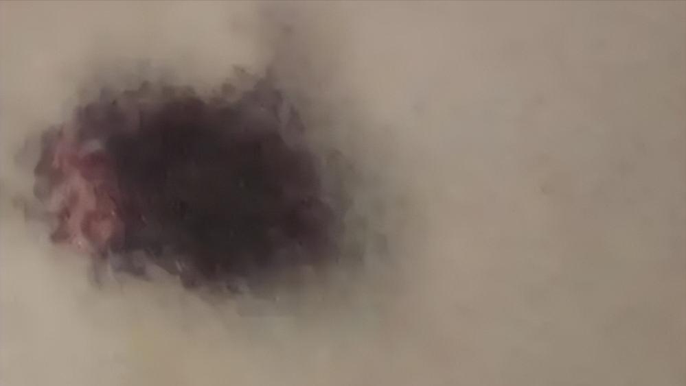 酱油变皮肤黑吃会怎么样_多吃酱油皮肤会变黑吗_酱油变皮肤黑吃会变白吗