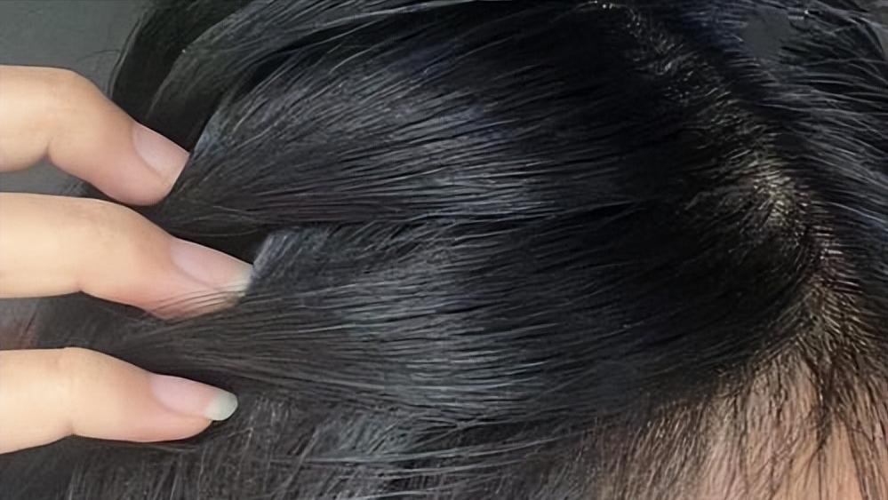 酱油变皮肤黑吃会怎么样_多吃酱油皮肤会变黑吗_酱油变皮肤黑吃会变白吗