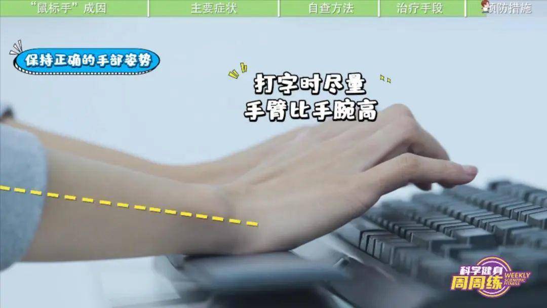 腕管综合征 预防治疗 鼠标手症状_健身手套 护腕